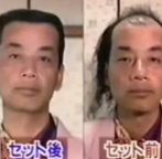 Amazing Japanese Hair Combover