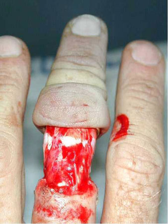 Don't wear ring for heavy labour job Don't wear ring for heavy labour job