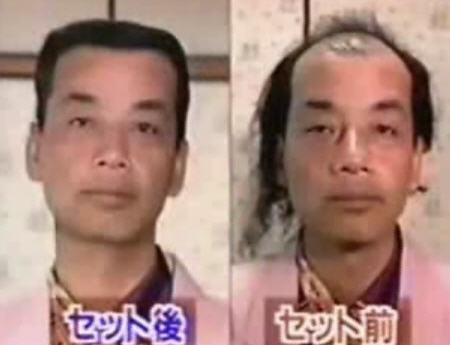 Amazing Japanese Hair Combover