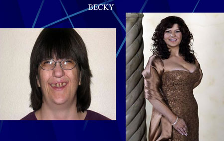 before and after