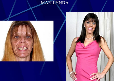 before and after