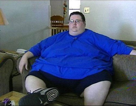 Before and After Losing 180kg